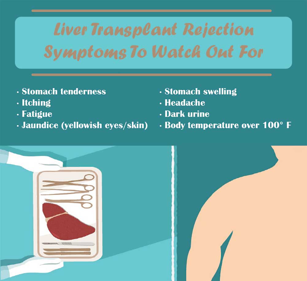 Liver Transplant Rejection: Symptoms