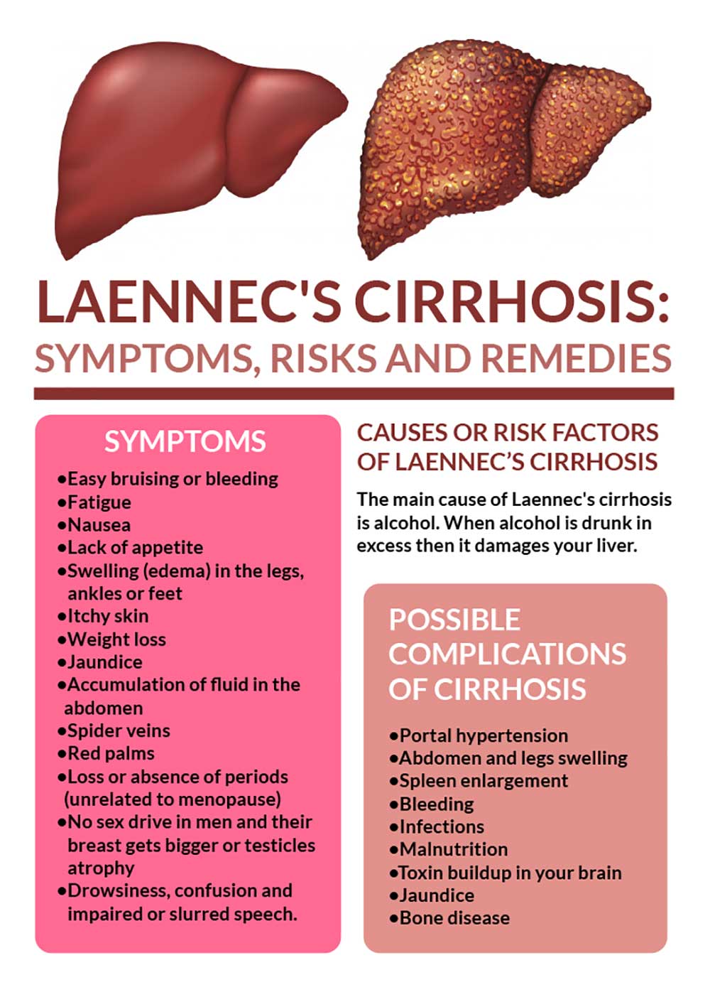 signs, symptoms, remedies of liver cirrhosis