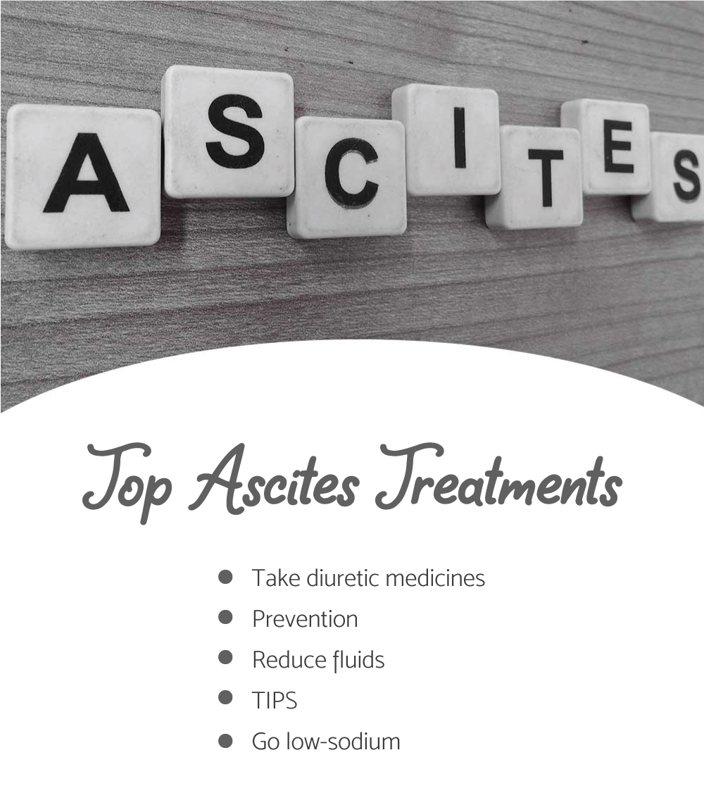top ascites treatment