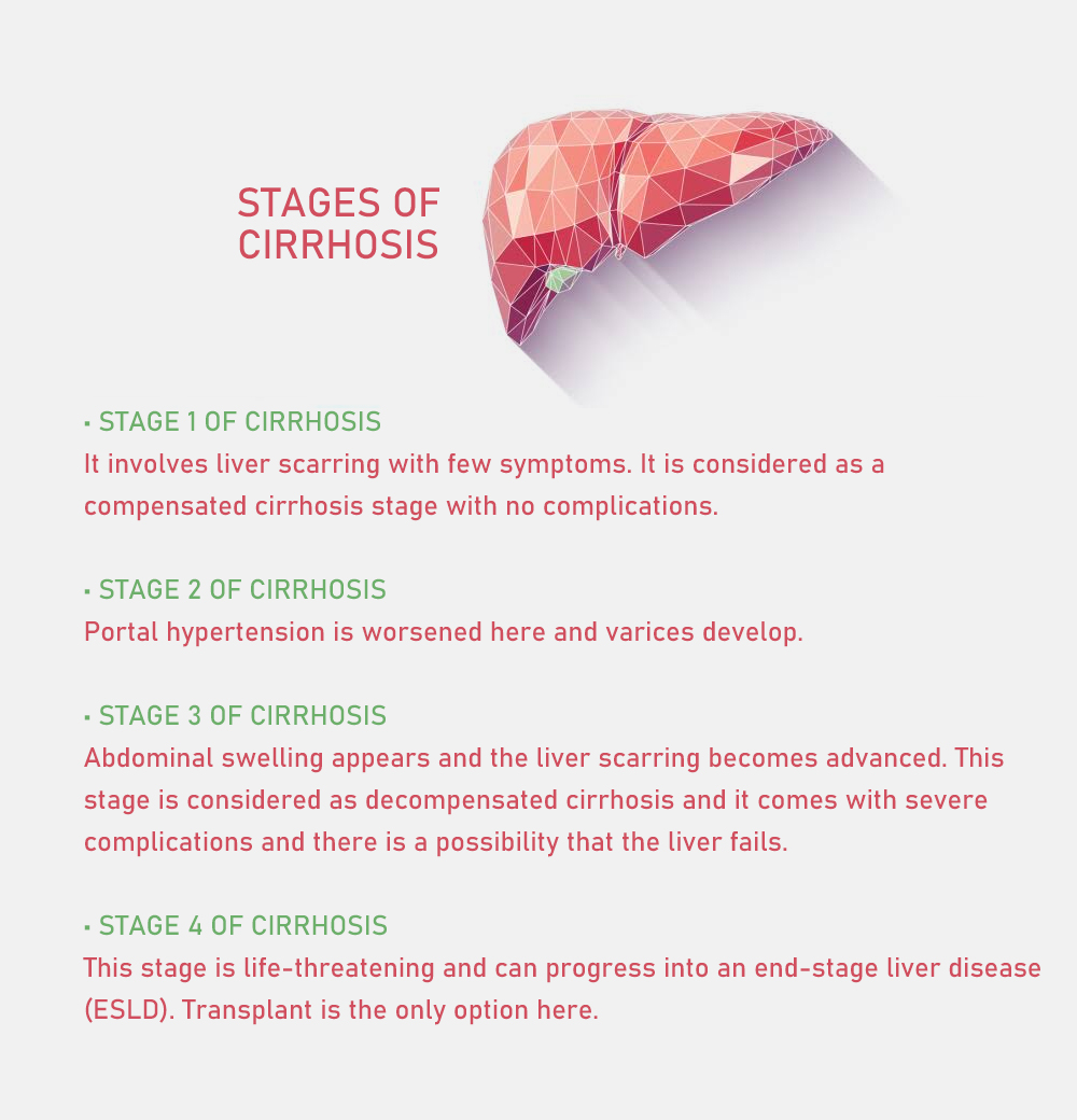 stages of cirrhosis