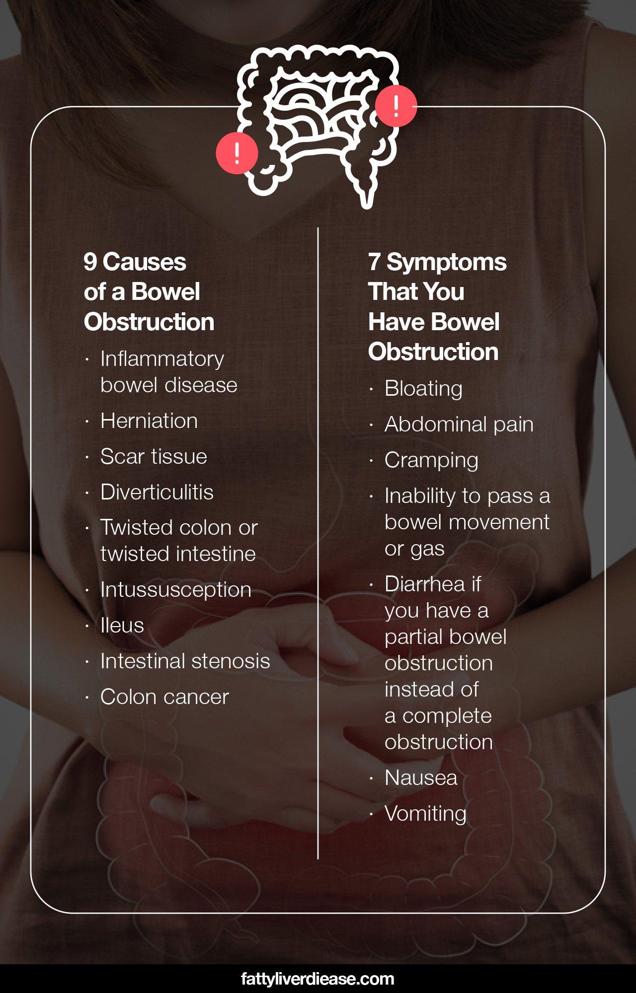 9 Causes of a Bowel Obstruction