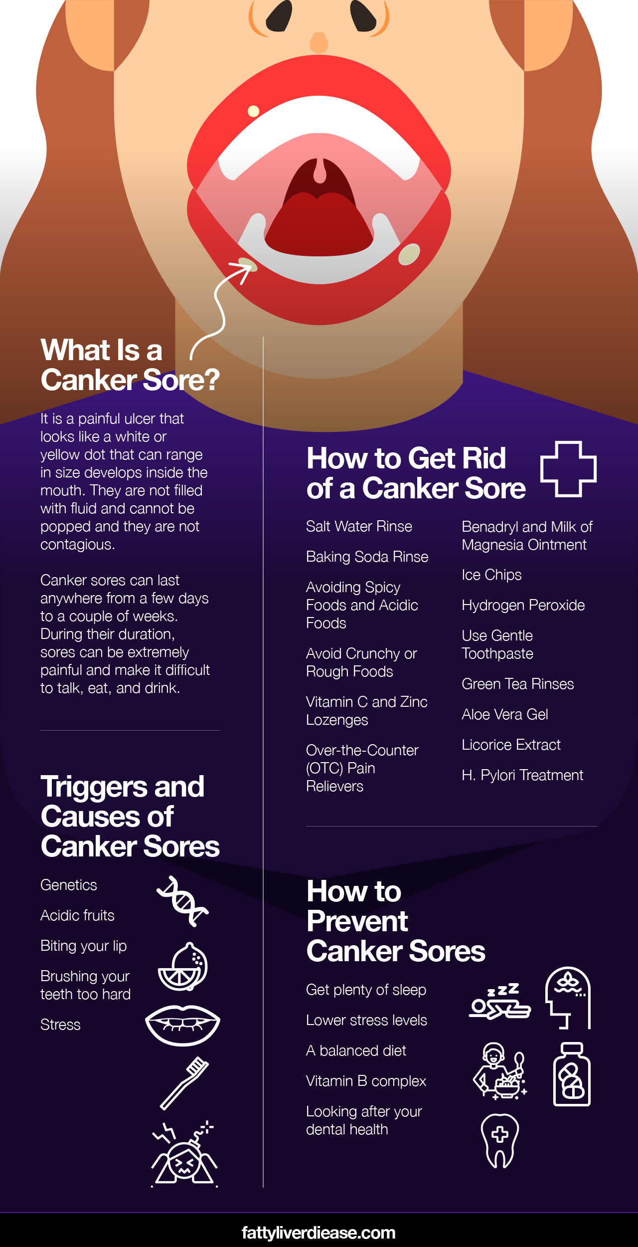 What Is a Canker Sore?