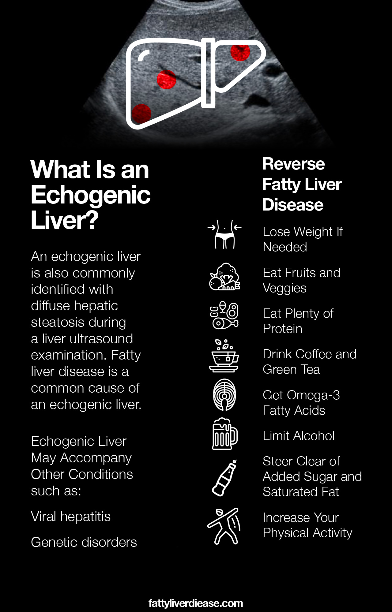 What Is an Echogenic Liver?